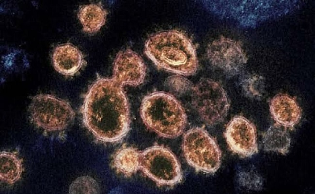 Langya henipavirus