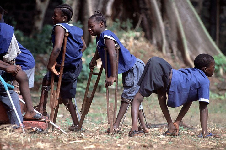 Victims of polio. The WHO reveals that Nigeria reported its third polio case in the northeastern state of Borno