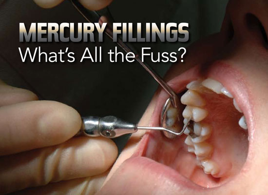 mercury-fillings