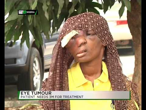 Video: Eye tumour