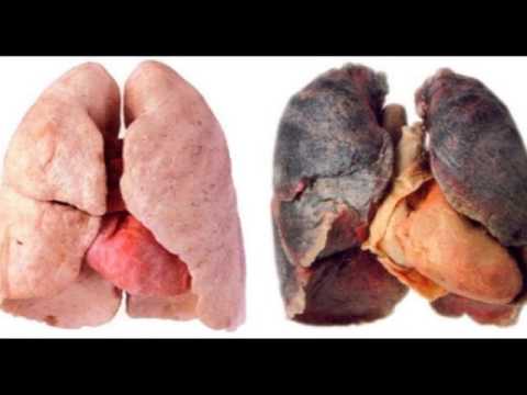TV Report: Group raises concern over tobacco regulations, importation