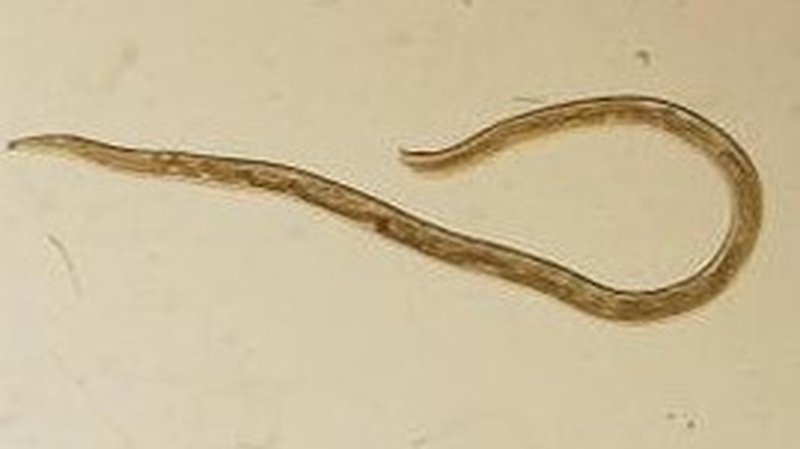 eye worm