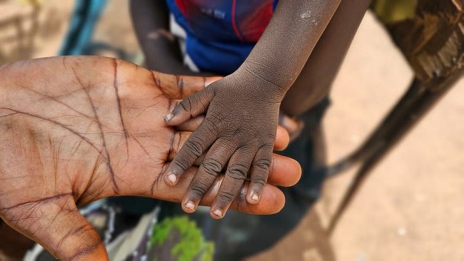 South Sudan